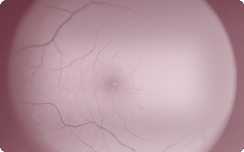 Fovea